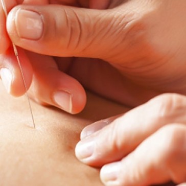 Move Osteopathy - Acupuncture