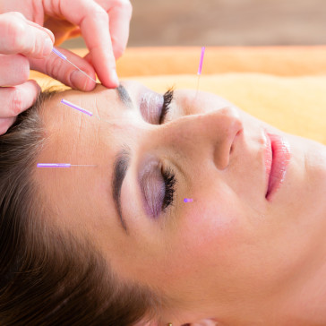 Parramatta Physio on Church - Acupunture